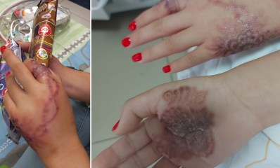 כווית חינה - בית חולים מאיר