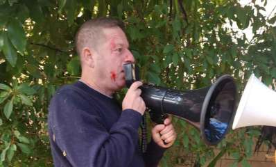 פציעה בפנים של ירירון גדות נאבק במפגין. אוחז מגאפון בידון גדות בהפגנה הבוקר מול בית הפצ"רית ברמת השרון