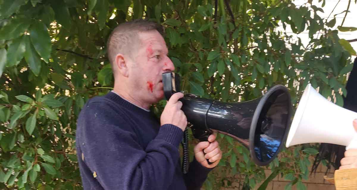 פציעה בפנים של ירירון גדות נאבק במפגין. אוחז מגאפון בידון גדות בהפגנה הבוקר מול בית הפצ"רית ברמת השרון