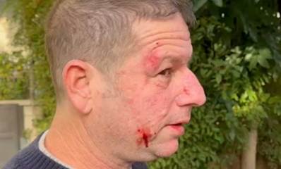 ירון גדות נאבק במפגין. אוחז מגאפון ביד