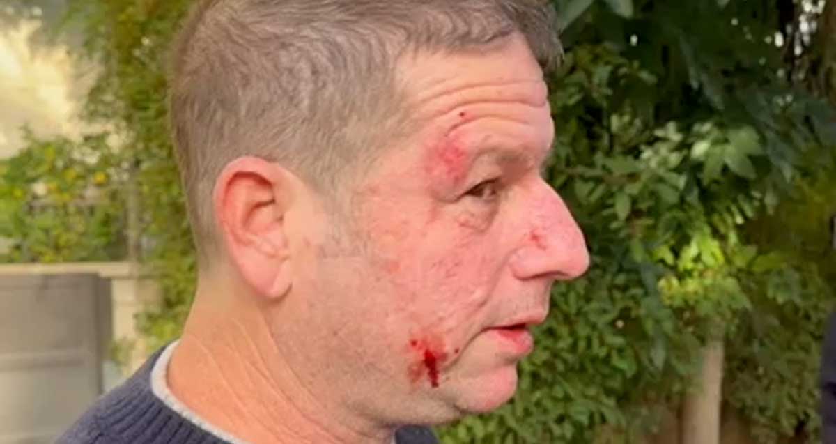 ירון גדות נאבק במפגין. אוחז מגאפון ביד